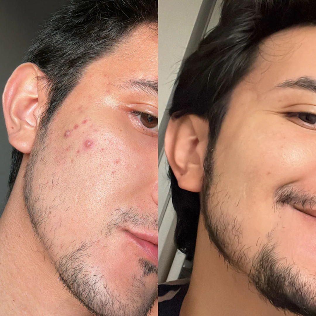 Beard & Face Freshness Kit - Image 3